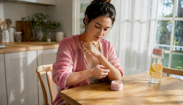 Young woman checking eczema on arm