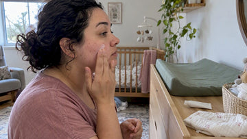 Parent applying topical acne treatment to cheek