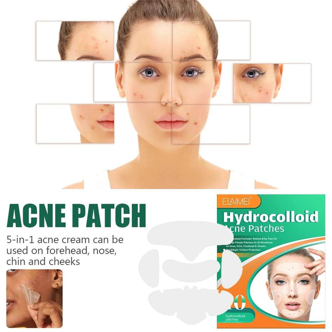Pimple Patch
